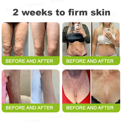 👨‍⚕️Made and shipped from USA💫 Botox & Vita-A Retinol Shot Wrinkle-Lift Tightening cream - Last Day Promotion 70% OFF