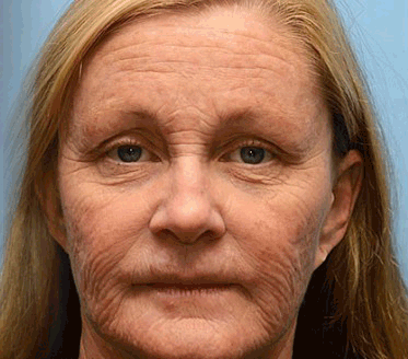 👨‍⚕️Made and shipped from USA💫 Botox & Vita-A Retinol Shot Wrinkle-Lift Tightening cream - Last Day Promotion 70% OFF